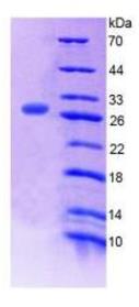 SDS-PAGE (MED1-436H).jpg